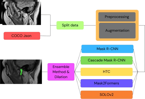 AI Model